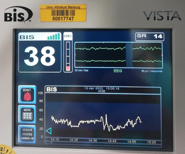 Awareness und Narkosetiefenmonitoring - Lieber ein bisschen wach als ...